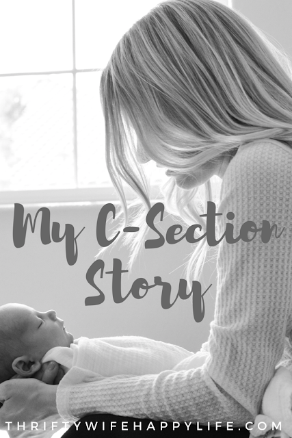 My C-section Story