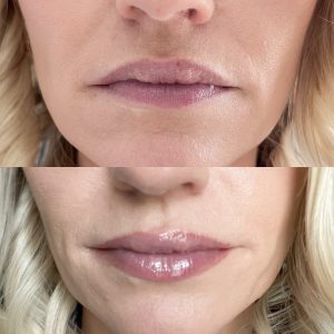 City Lips Plumping Lip Gloss before and after.